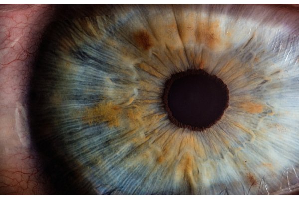 Picture of an eye